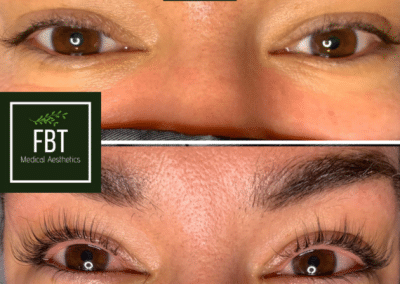 Lash Lift and Tint patient Before and After photos from FBTMed, Faith in Beauty in Medway MA