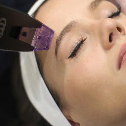Microneedling from Faith in Beauty Medical Aesthetics in Medway MA