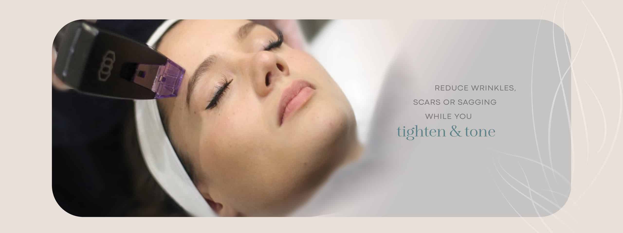 Microneedling at FBT Faith in Beauty Medical Aesthetics in Medway MA